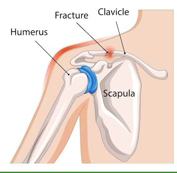 Humerus 