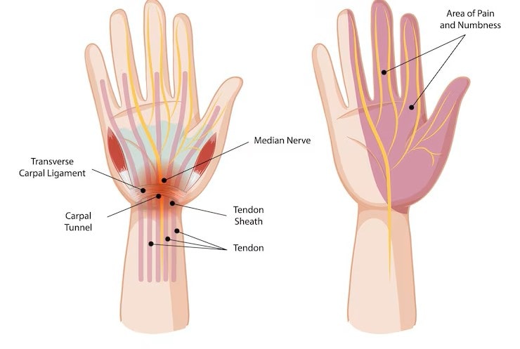 Wrist Nerve